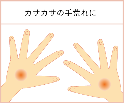 手指がカサカサ