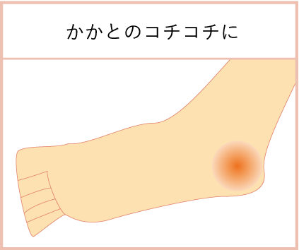 かかとがコチコチ